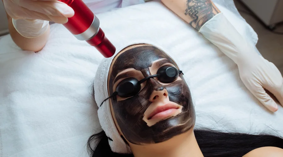 Carbon Facial