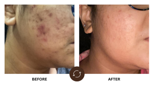 ba 07 - Dr. Reshma Ahuja | Best Dermatologist and Skin Specialist in Powai