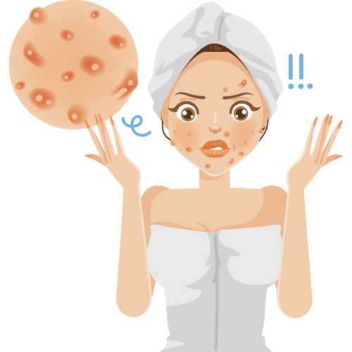 Acne treatments in Mumbai, best dermatologist in Powai