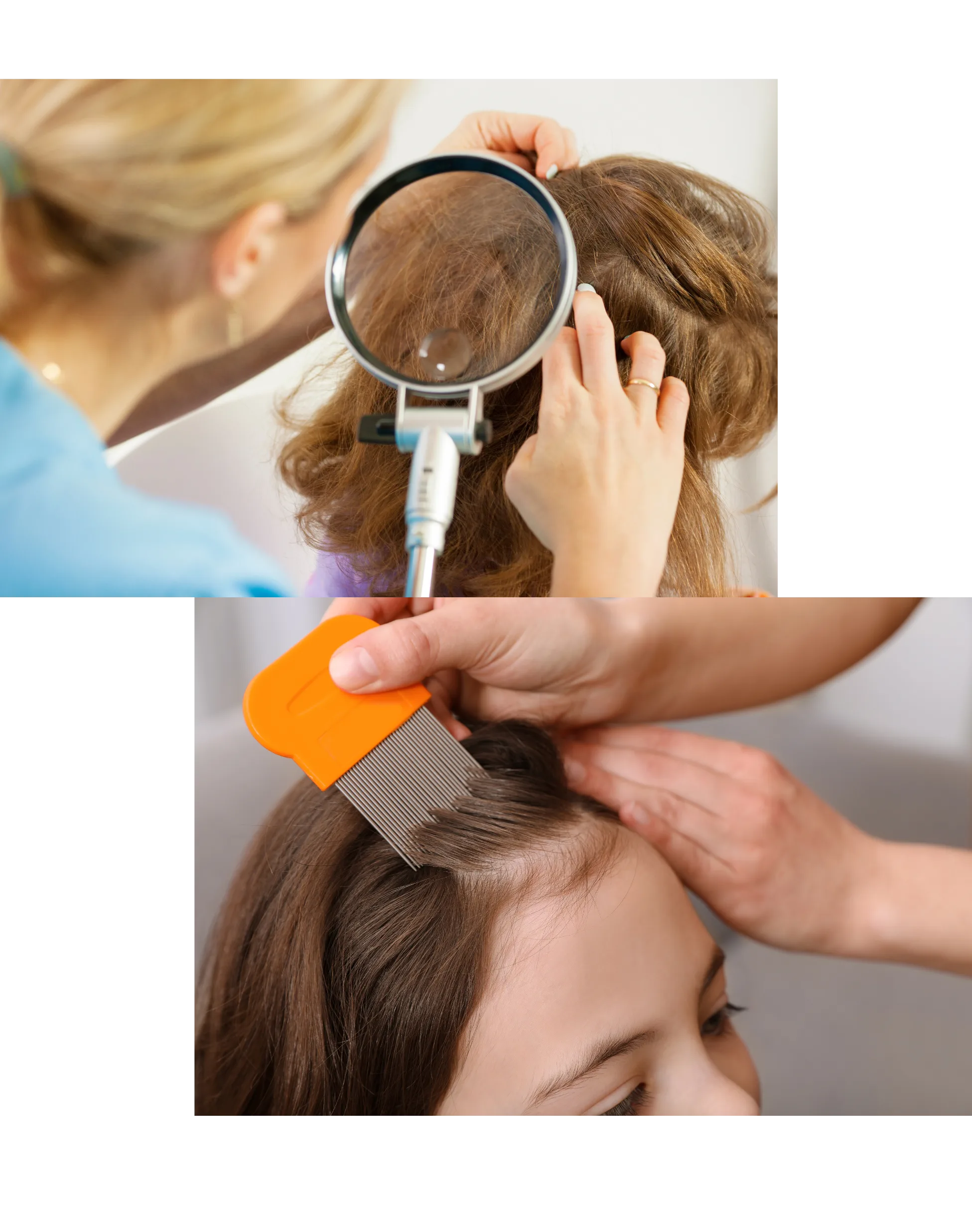 Lice treatment in Powai, best dermatologist and trichologist