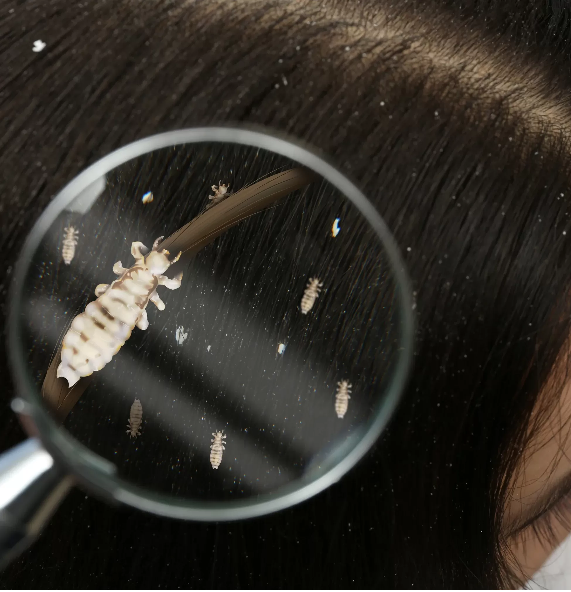 Best lice treatment in Powai, best hair specialist