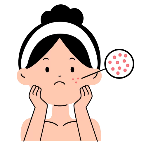 Acne Scar Treatments