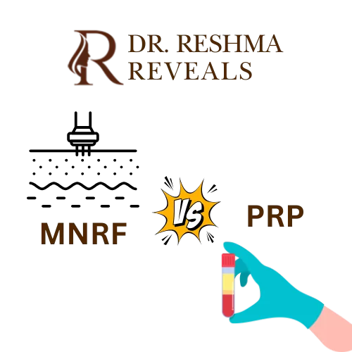 Microneedling vs PRP