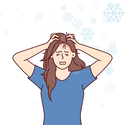 How Cold Weather Leads to Flaky Scalp
