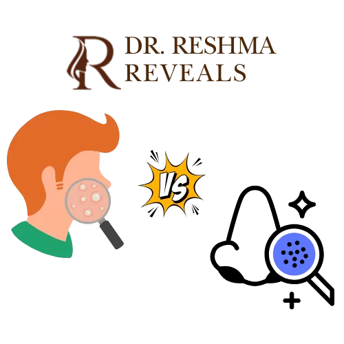 Whiteheads vs Blackheads