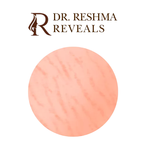 Can I remove stretch marks completely - Dr. Reshma Reveals - Best dermatologist in Powai