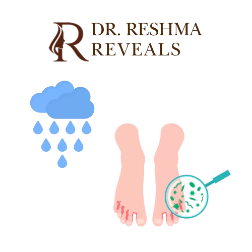 Why Do Your Feet Smell and Itch So Much in Monsoon?